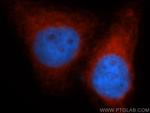 VAPB Antibody in Immunocytochemistry (ICC/IF)