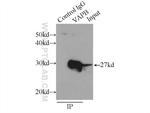 VAPB Antibody in Immunoprecipitation (IP)