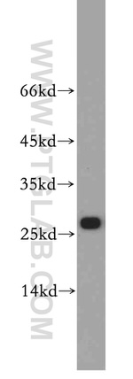 VAPB Antibody in Western Blot (WB)