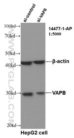 VAPB Antibody in Western Blot (WB)