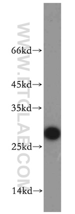 VAPB Antibody in Western Blot (WB)