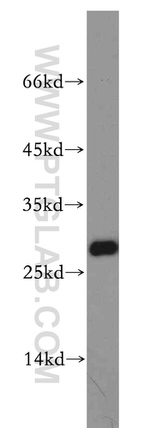 VAPB Antibody in Western Blot (WB)