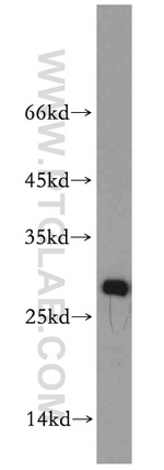 VAPB Antibody in Western Blot (WB)