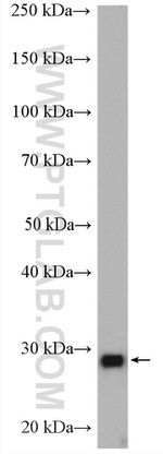 VAPB Antibody in Western Blot (WB)