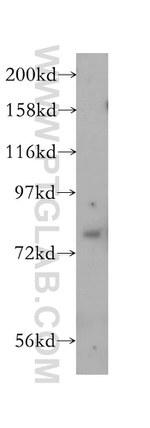 SIRP alpha Antibody in Western Blot (WB)