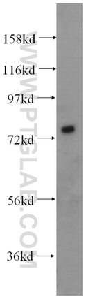 SIRP alpha Antibody in Western Blot (WB)