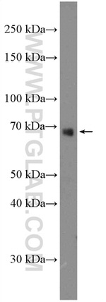 SIRP alpha Antibody in Western Blot (WB)