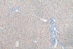 p70(S6K) Antibody in Immunohistochemistry (Paraffin) (IHC (P))