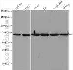 p70(S6K) Antibody in Western Blot (WB)