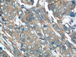 p70(S6K) Antibody in Immunohistochemistry (Paraffin) (IHC (P))