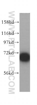 p70(S6K) Antibody in Western Blot (WB)