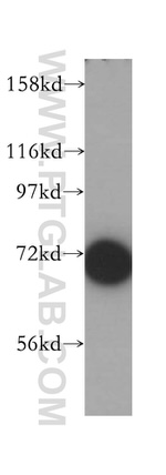 p70(S6K) Antibody in Western Blot (WB)