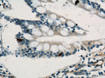 CD34 Antibody in Immunohistochemistry (Paraffin) (IHC (P))