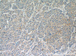 CD34 Antibody in Immunohistochemistry (Paraffin) (IHC (P))