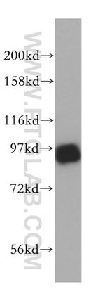 PNPT1 Antibody in Western Blot (WB)
