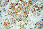 PNPT1 Antibody in Immunohistochemistry (Paraffin) (IHC (P))