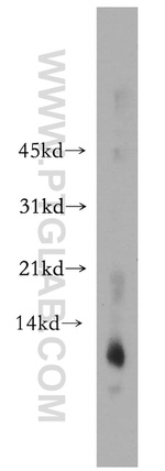 DBI Antibody in Western Blot (WB)