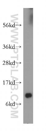 DBI Antibody in Western Blot (WB)