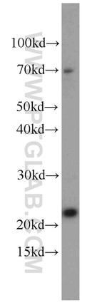 RPS7 Antibody in Western Blot (WB)