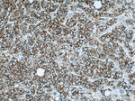 HBXIP Antibody in Immunohistochemistry (Paraffin) (IHC (P))