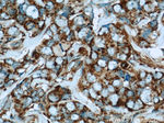 HBXIP Antibody in Immunohistochemistry (Paraffin) (IHC (P))