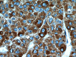 HBXIP Antibody in Immunohistochemistry (Paraffin) (IHC (P))