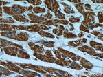 HBXIP Antibody in Immunohistochemistry (Paraffin) (IHC (P))