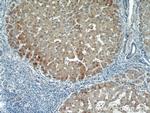 HBXIP Antibody in Immunohistochemistry (Paraffin) (IHC (P))