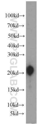 Gastrokine 1 Antibody in Western Blot (WB)