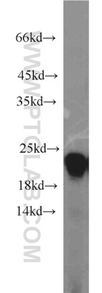 Gastrokine 1 Antibody in Western Blot (WB)