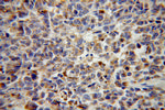 VTI1B Antibody in Immunohistochemistry (Paraffin) (IHC (P))