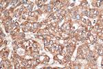 VTI1B Antibody in Immunohistochemistry (Paraffin) (IHC (P))