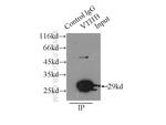 VTI1B Antibody in Immunoprecipitation (IP)