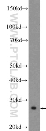 VTI1B Antibody in Western Blot (WB)