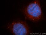 CEP250/CNAP1 Antibody in Immunocytochemistry (ICC/IF)