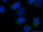 CEP250/CNAP1 Antibody in Immunocytochemistry (ICC/IF)