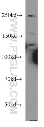 CEP250/CNAP1 Antibody in Western Blot (WB)