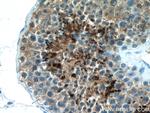 PRM2 Antibody in Immunohistochemistry (Paraffin) (IHC (P))