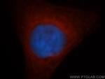 GSTM5 Antibody in Immunocytochemistry (ICC/IF)