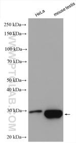 GSTM5 Antibody in Western Blot (WB)