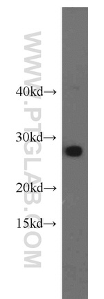 GSTM5 Antibody in Western Blot (WB)