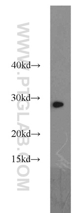 GSTM5 Antibody in Western Blot (WB)