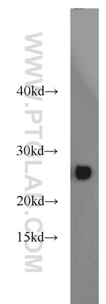 GSTM5 Antibody in Western Blot (WB)