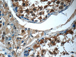 14-3-3 Antibody in Immunohistochemistry (Paraffin) (IHC (P))