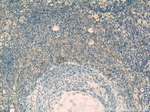 CROP Antibody in Immunohistochemistry (Paraffin) (IHC (P))