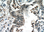 CROP Antibody in Immunohistochemistry (Paraffin) (IHC (P))