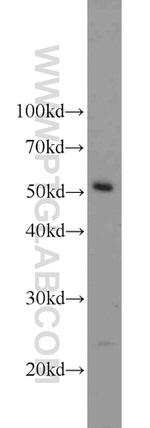 CROP Antibody in Western Blot (WB)