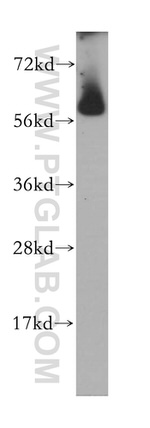 CROP Antibody in Western Blot (WB)