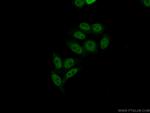 CROP Antibody in Immunocytochemistry (ICC/IF)