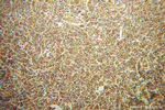 GRAP Antibody in Immunohistochemistry (Paraffin) (IHC (P))